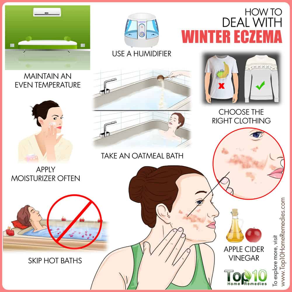 How to Deal with Winter Eczema