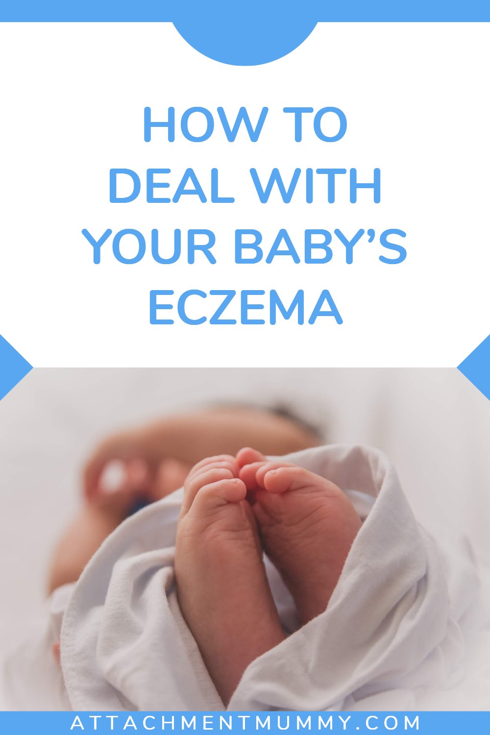 How To Deal With Your Babys Eczema
