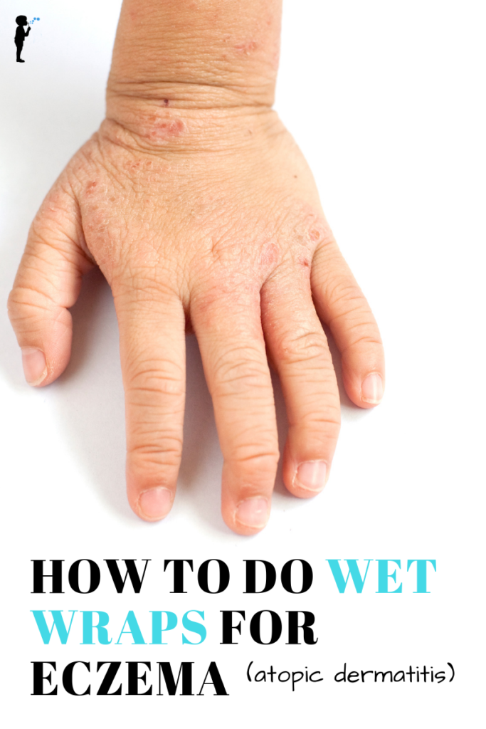 How to do wet wraps for eczema (atopic dermatitis)