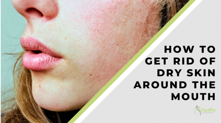 How To Get Rid Of Dry Skin Around The Mouth