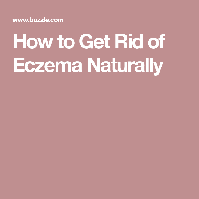 How to Get Rid of Eczema Naturally #howtogetridofpimples (With images ...