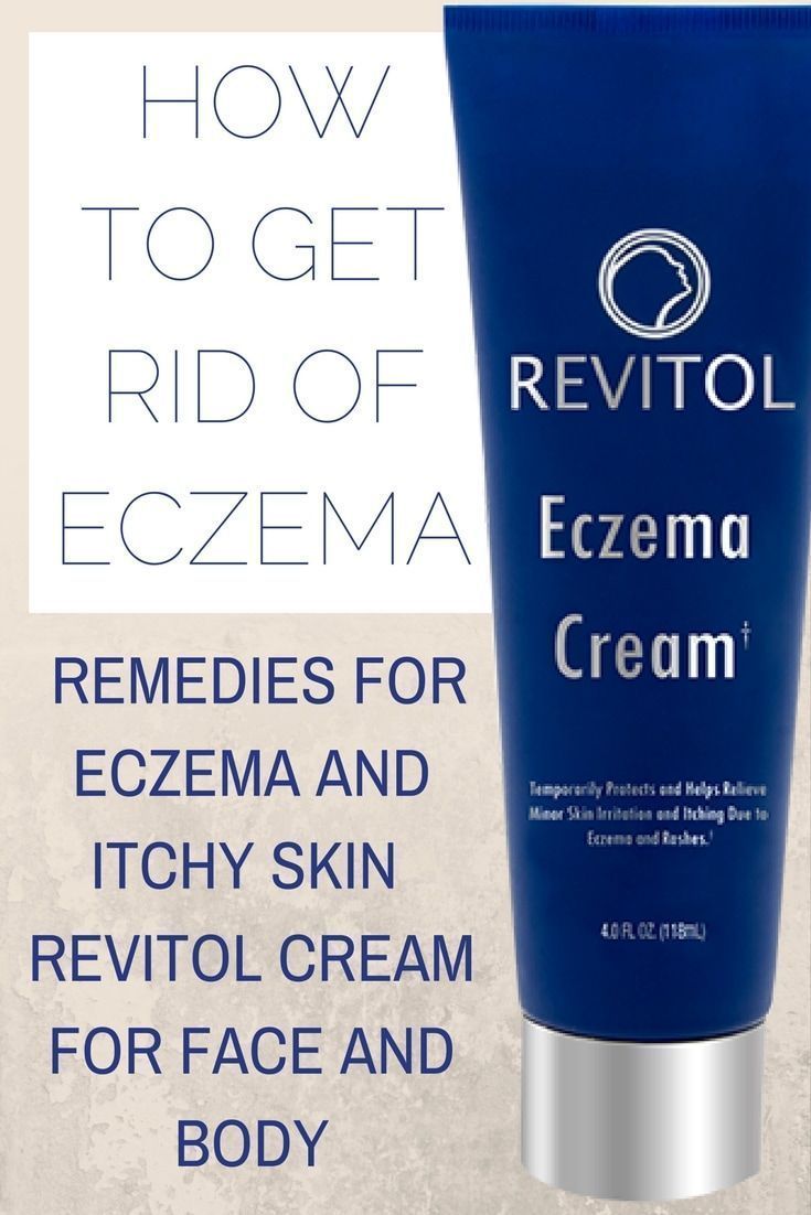 How to get rid of Eczema