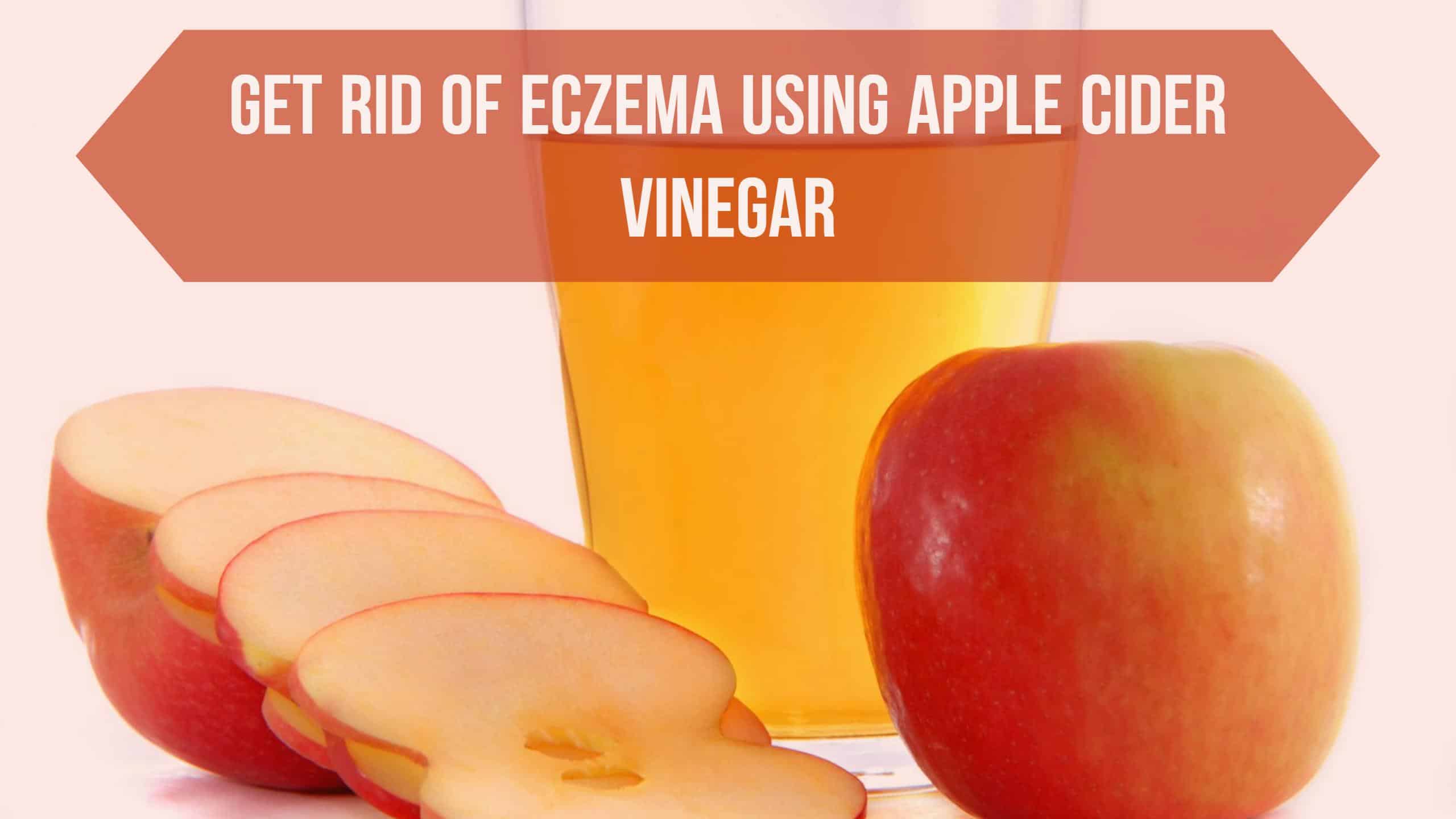 How to Get Rid of Eczema using Apple Cider Vinegar