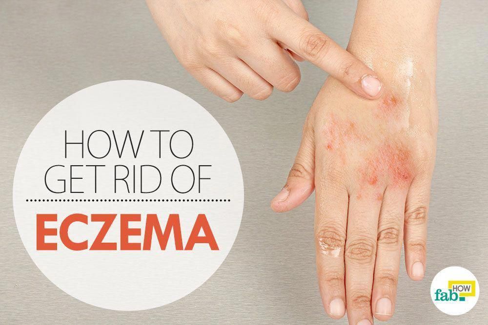 How To Get Rid Of Itchy Rash On Hands  Mednifico.com