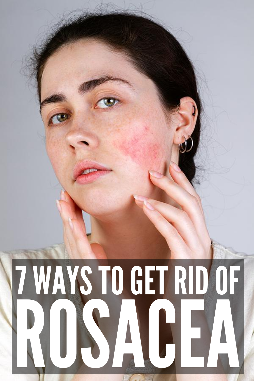 How to Get Rid of Rosacea: 7 Rosacea Remedies That Work