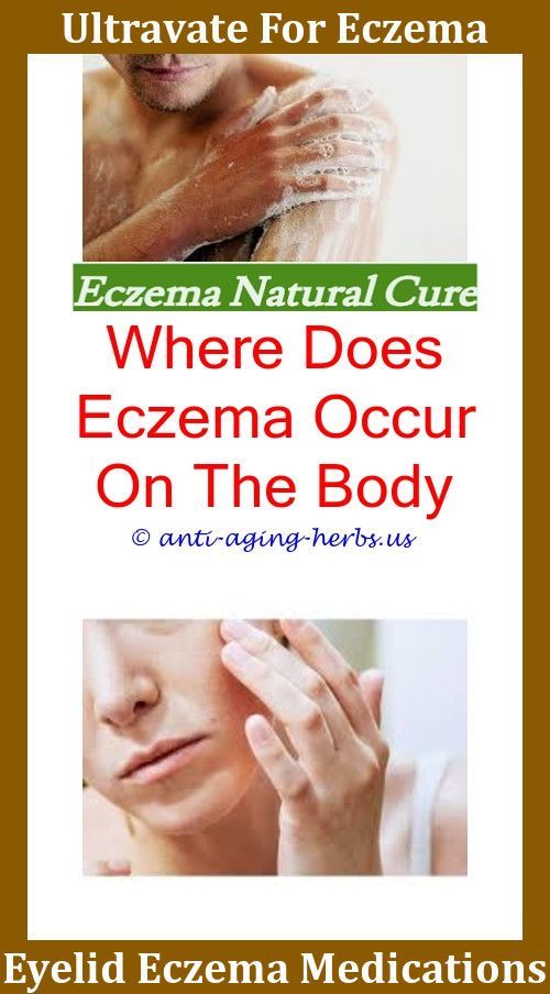 How To Get Rid Of Skin Discoloration From Eczema ...