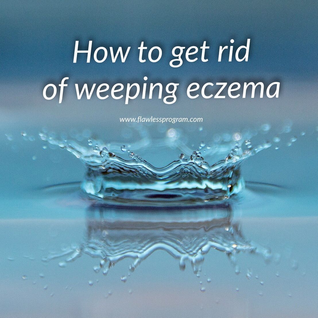 How to get rid of weeping eczema #RosaceaHelp ...