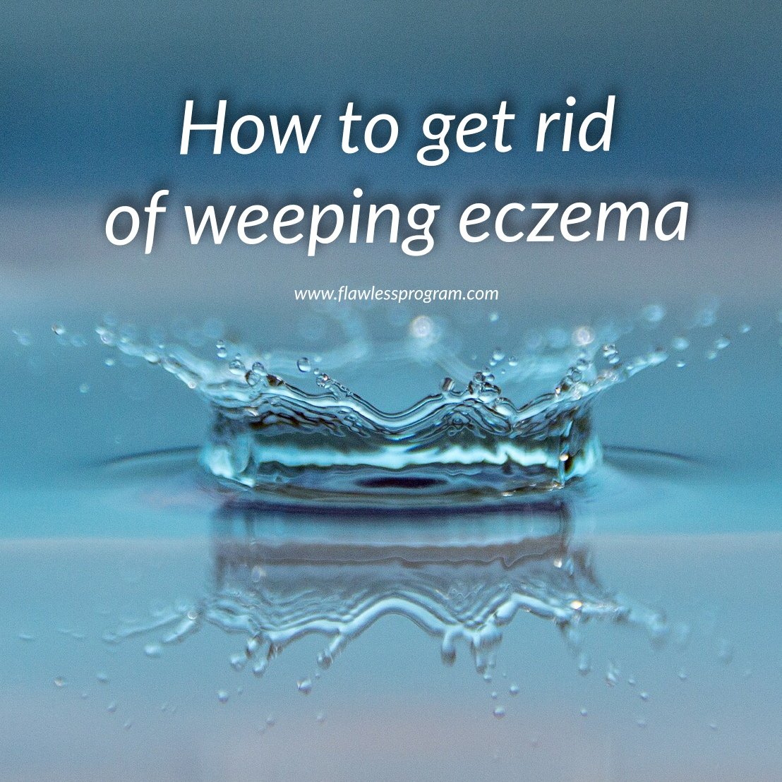 How to get rid of weeping eczema