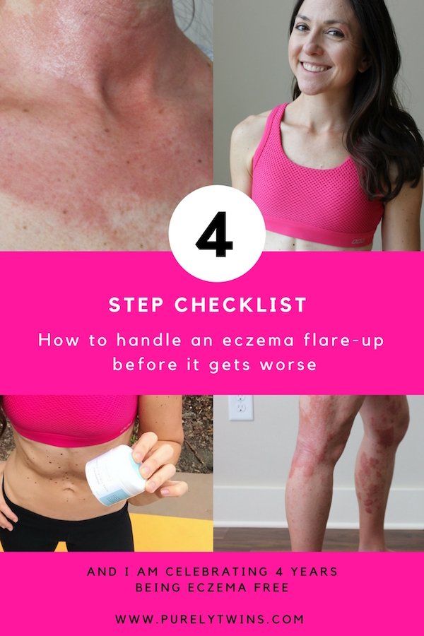 How to handle an eczema flare