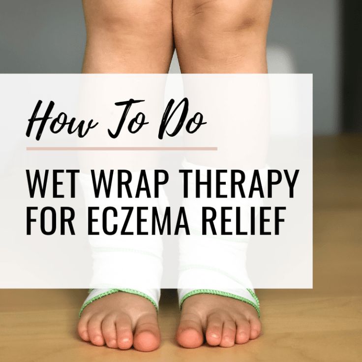 How to Heal Eczema Naturally From The Inside Out