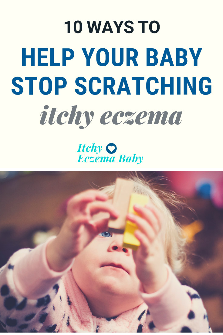 How to Help Your Baby Stop Scratching Eczema