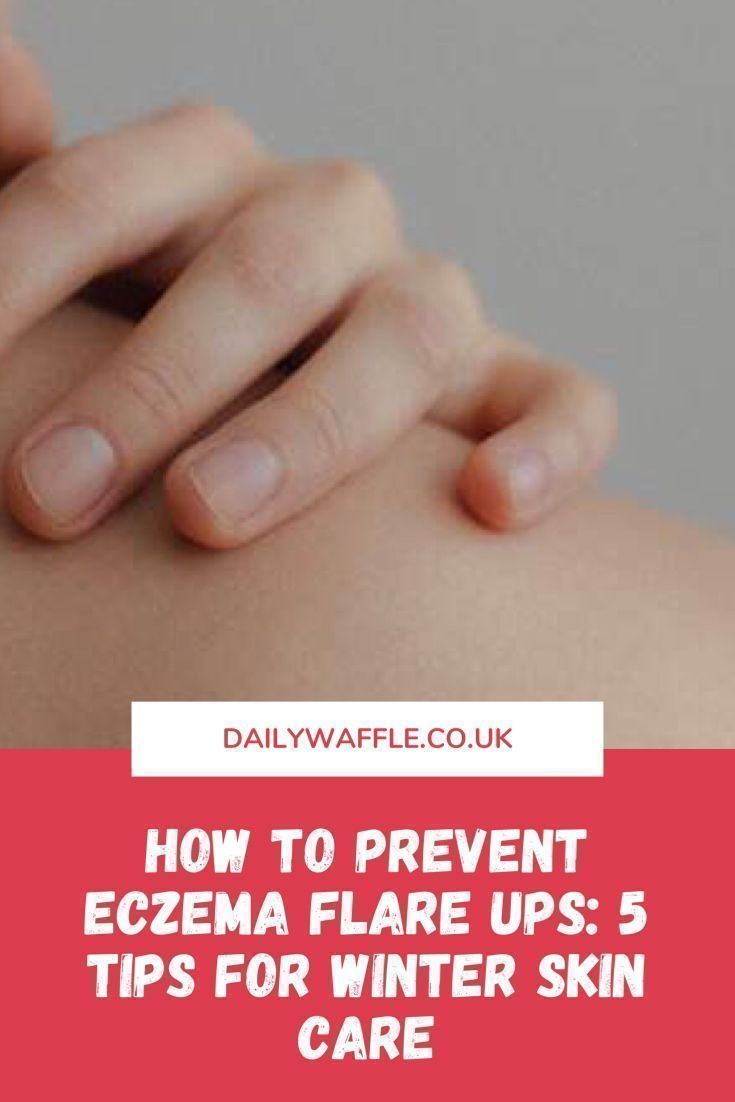 How to prevent eczema flare ups: 5 tips for winter skin ...