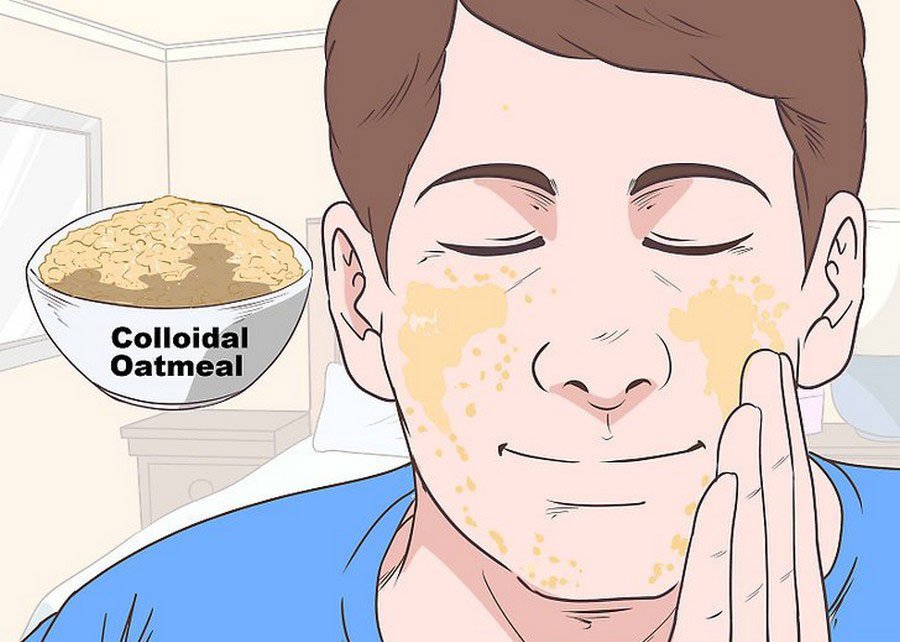 How to Stop Eczema from Spreading