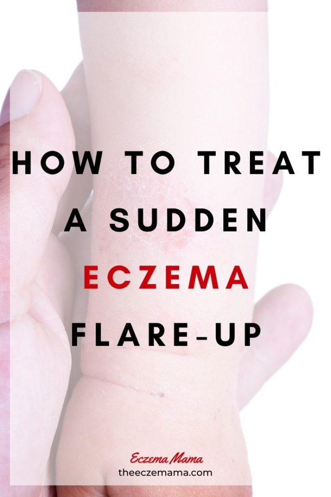 How to Treat a Sudden Eczema Flare