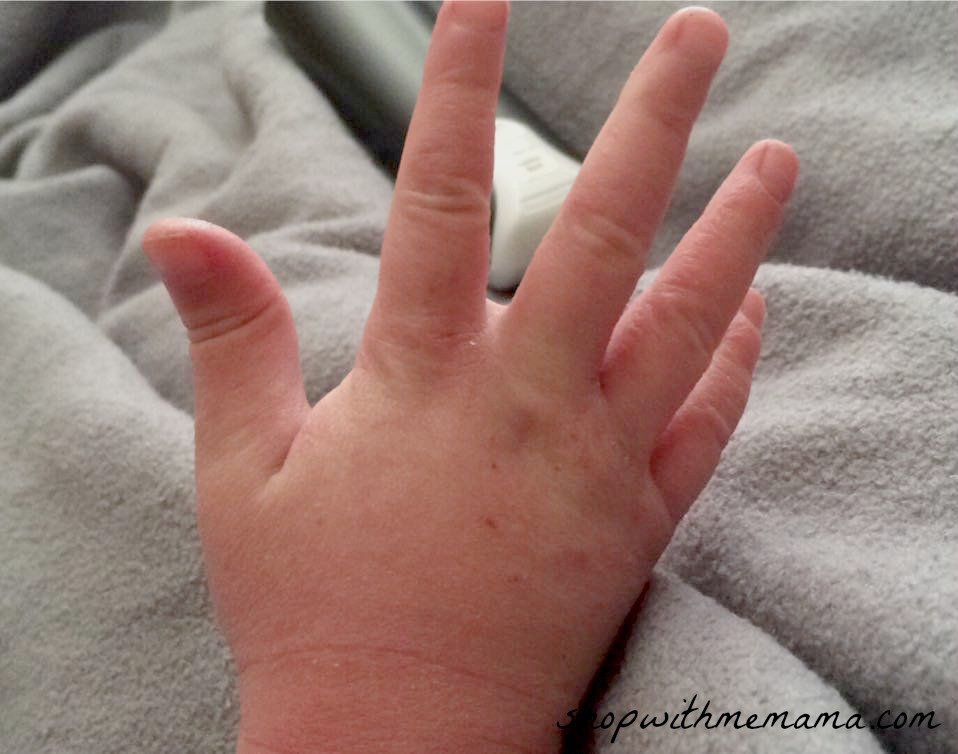How to treat and prevent eczema in children (Guest Post ...