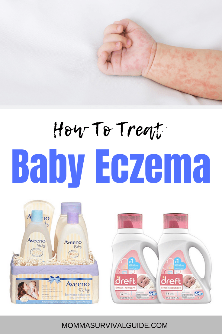 How To Treat Baby Eczema â Help Your Baby
