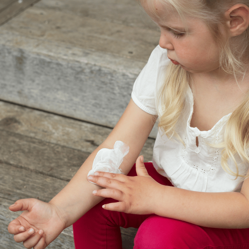 How to treat eczema naturally in children â MadeOn Skin Care