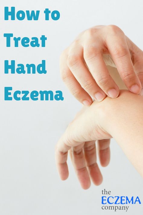 How to Treat Eczema on Hands (With images)