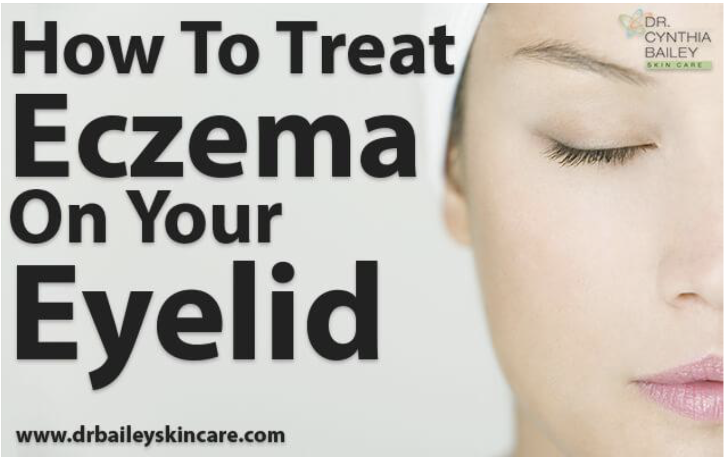 How To Treat Eczema on Your Eyelid