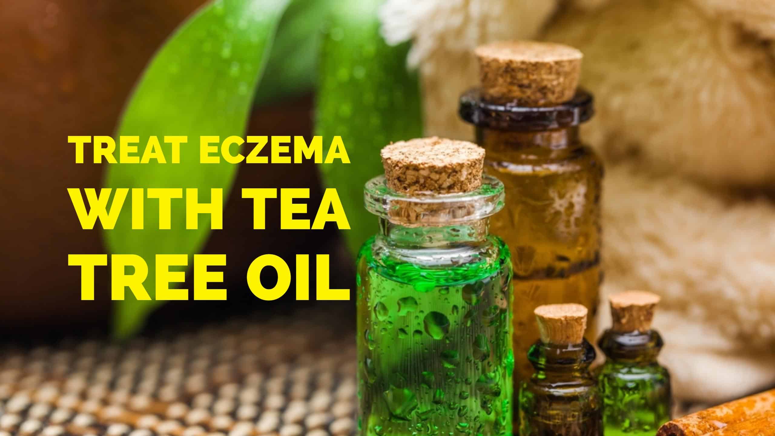 How to Treat Eczema using Tea Tree Oil