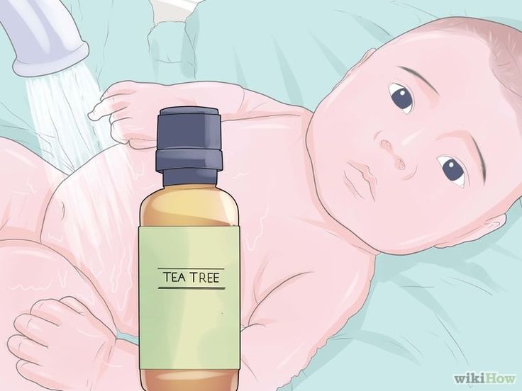 How to Treat Infant Eczema Naturally