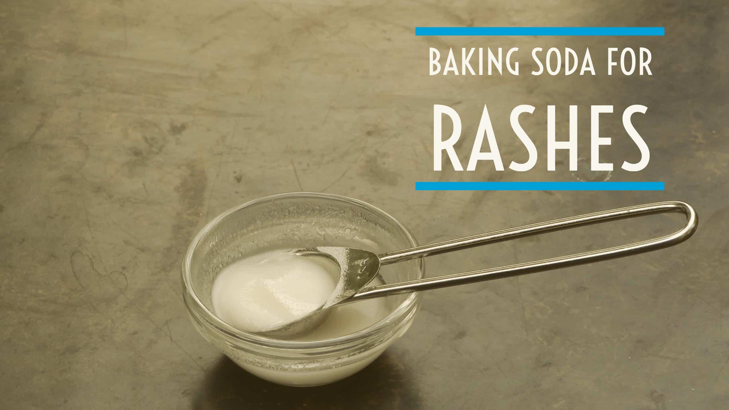 How to use Baking Soda for Rashes