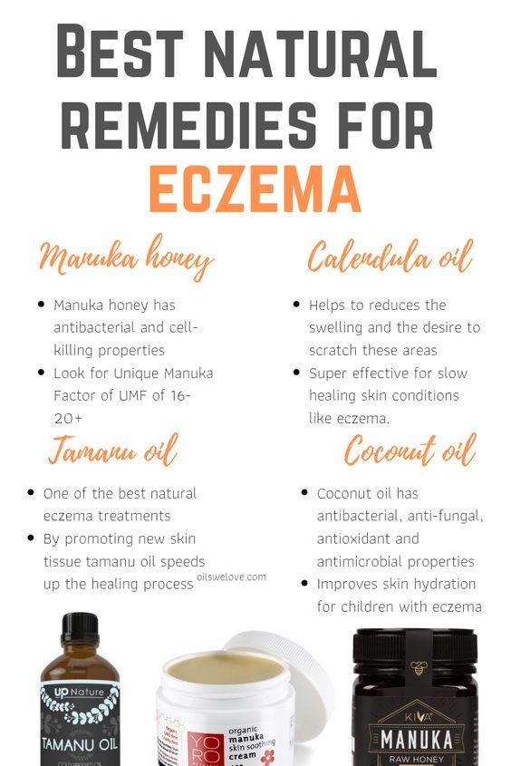 How to use manuka honey for eczema and cure it naturally ...