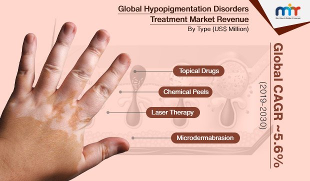 Hypopigmentation Disorders Treatment Market Size ...