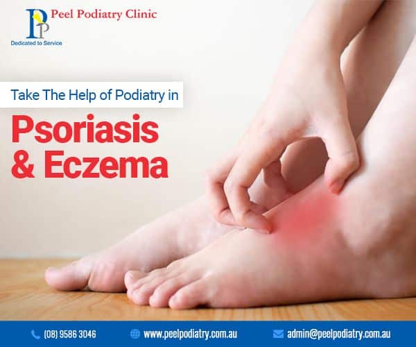 If youâre suffering from #Foot #Psoriasis or #Eczema, then get it ...