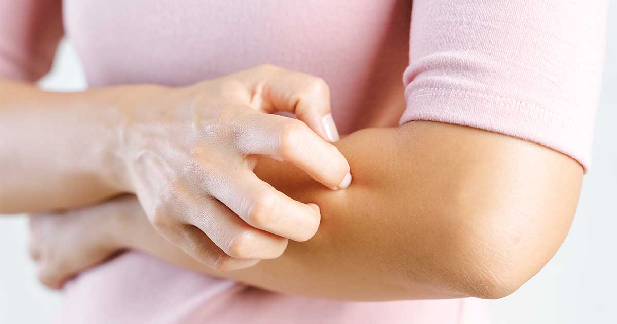 Is Eczema Itchy: Understanding the Source of the Itch