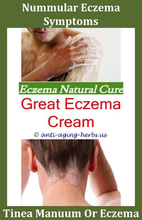 Kirk Castile Soap For Eczema,does humidity affect eczema.Eczema ...