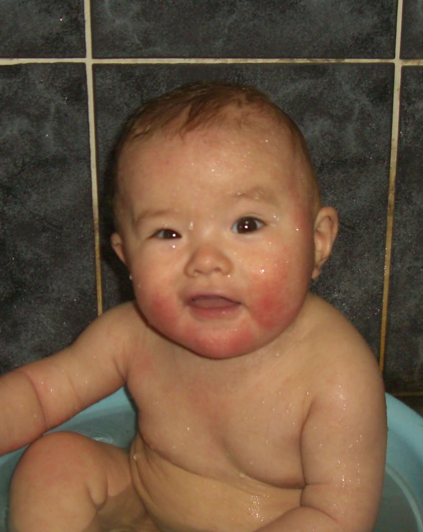 Life as a Housewife and Mum: Managing Eczema in our Baby Boy