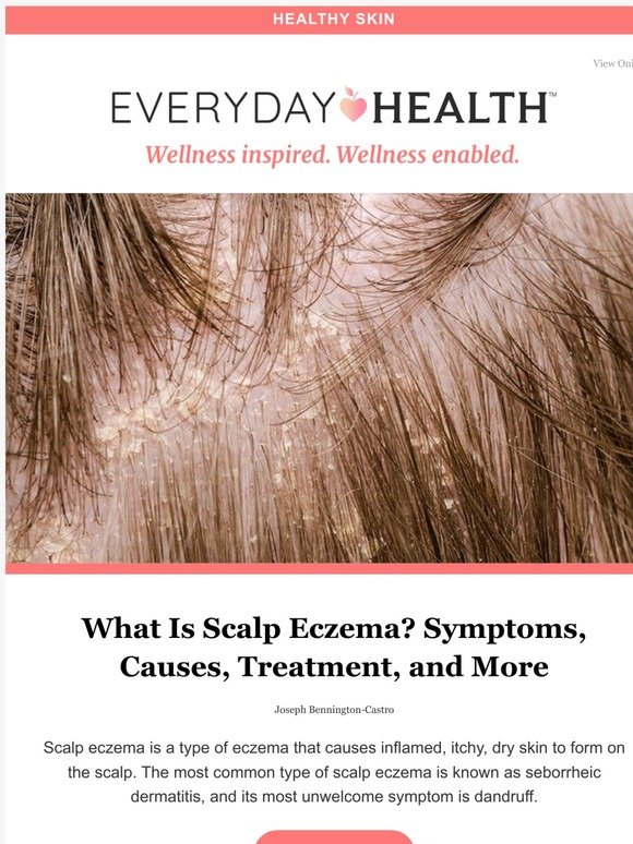 LIfescript: What Is Scalp Eczema? Symptoms, Causes ...