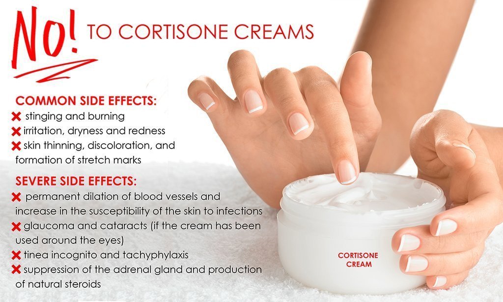 Low Down on Cortisone Steroid Creams  Skin Naturopath Holistic ...