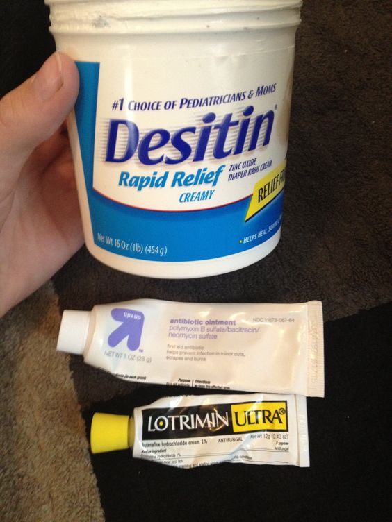 Magic diaper rash cream: Desitin mixed with lotrimin (takes care of ...