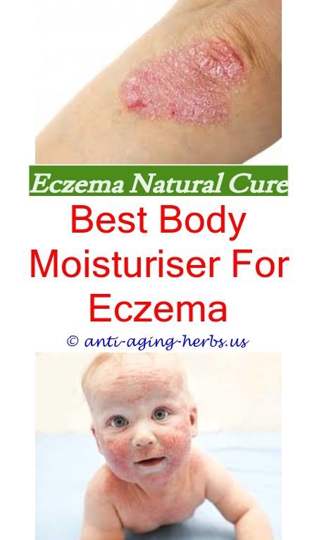 mild eczema on legs eczema healing process