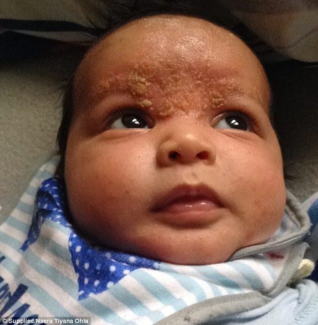 Mother reveals how change in diet and miracle cream helped cure baby