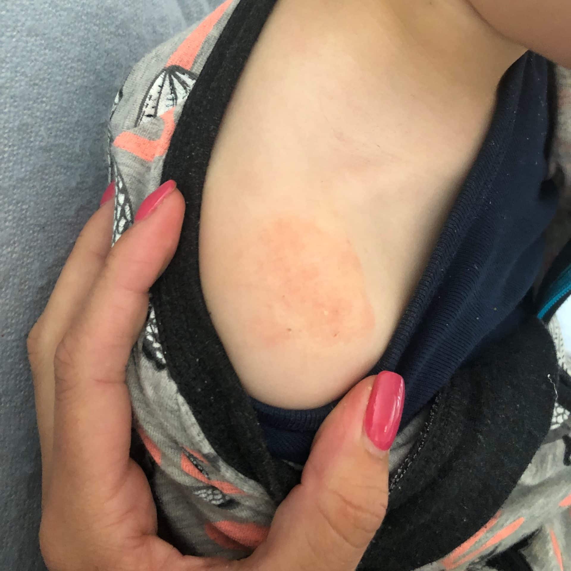 My baby/child has Eczema, What can I do to help?