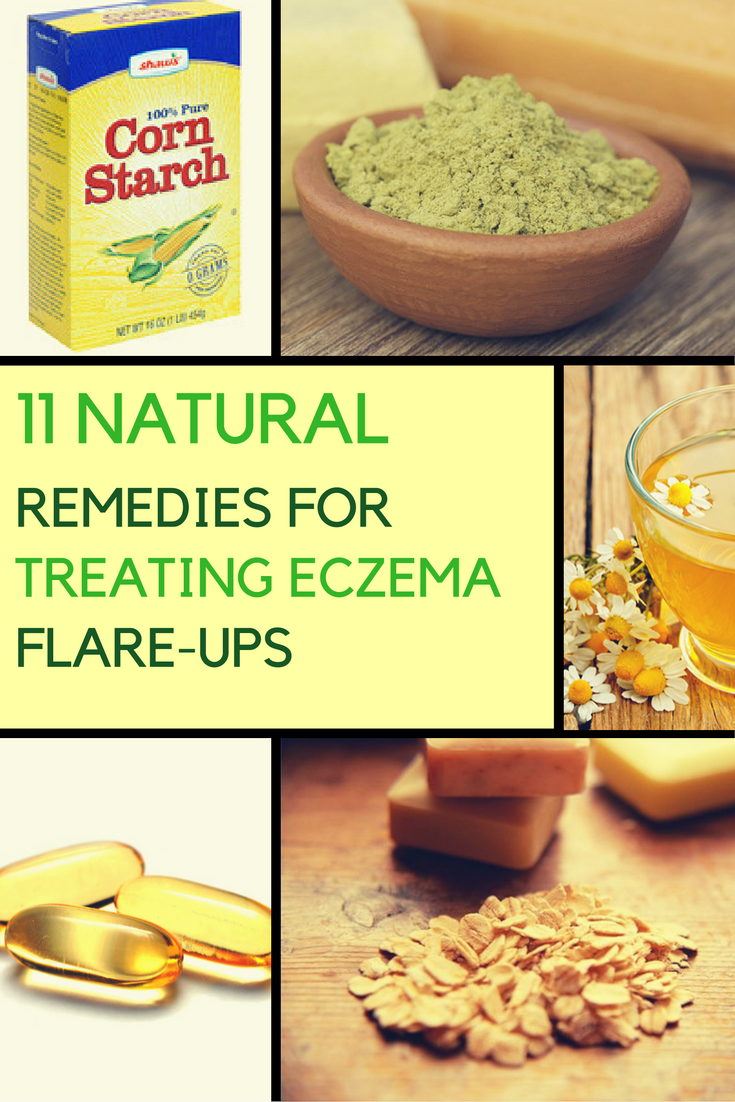 Natural Remedies for Eczema: 11 of Them That Really Work