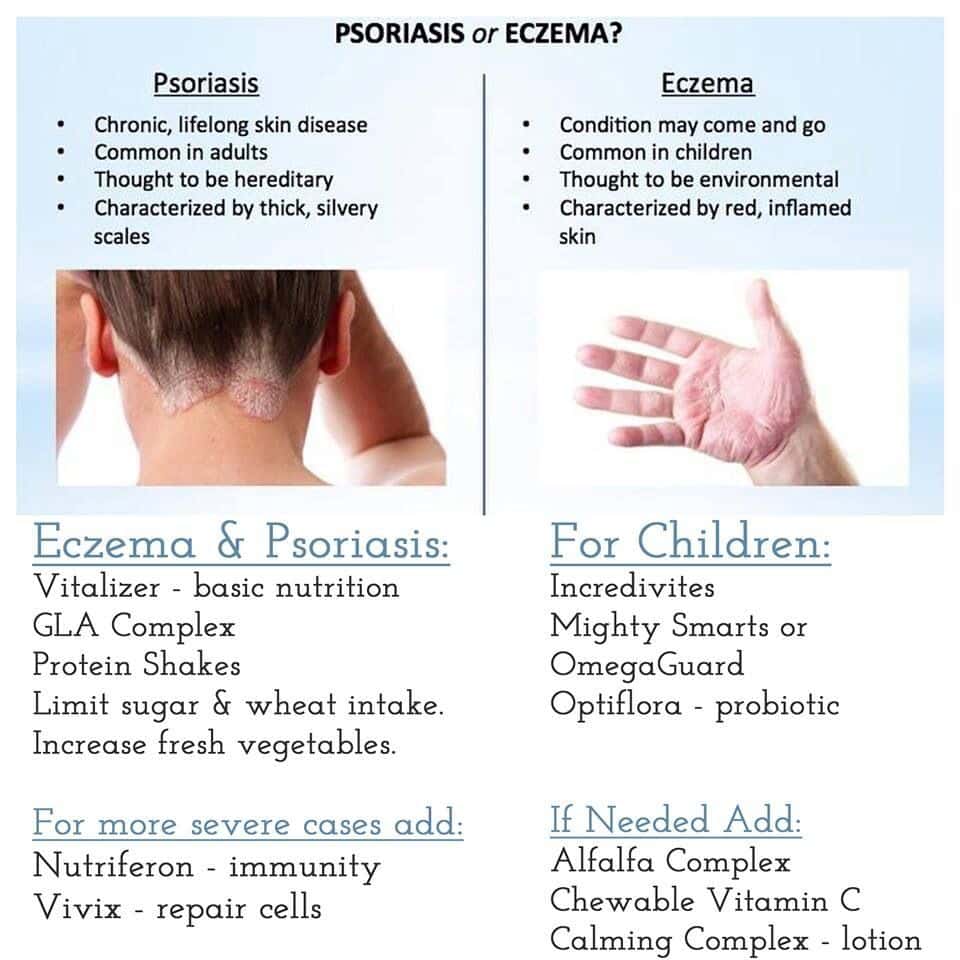 Natural solutions for eczema and psoriasis! #shaklee #eczema #psoriasis ...