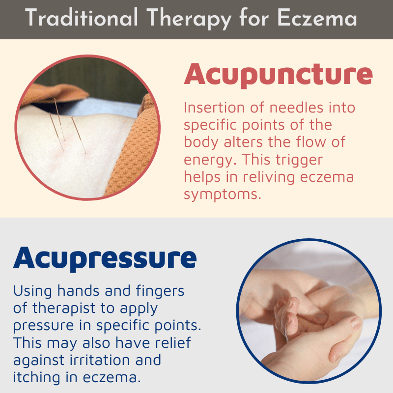 Natural Treatment Eczema
