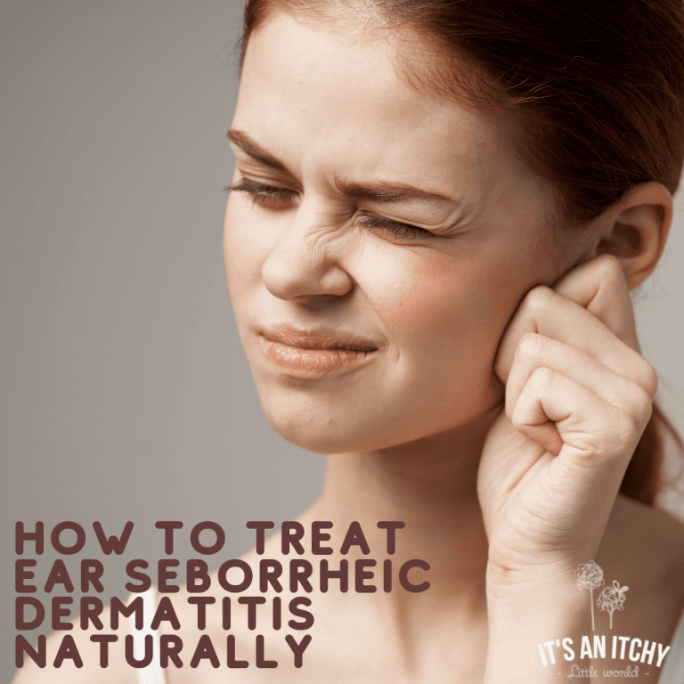 Natural Treatments for Ear Seborrheic Dermatitis