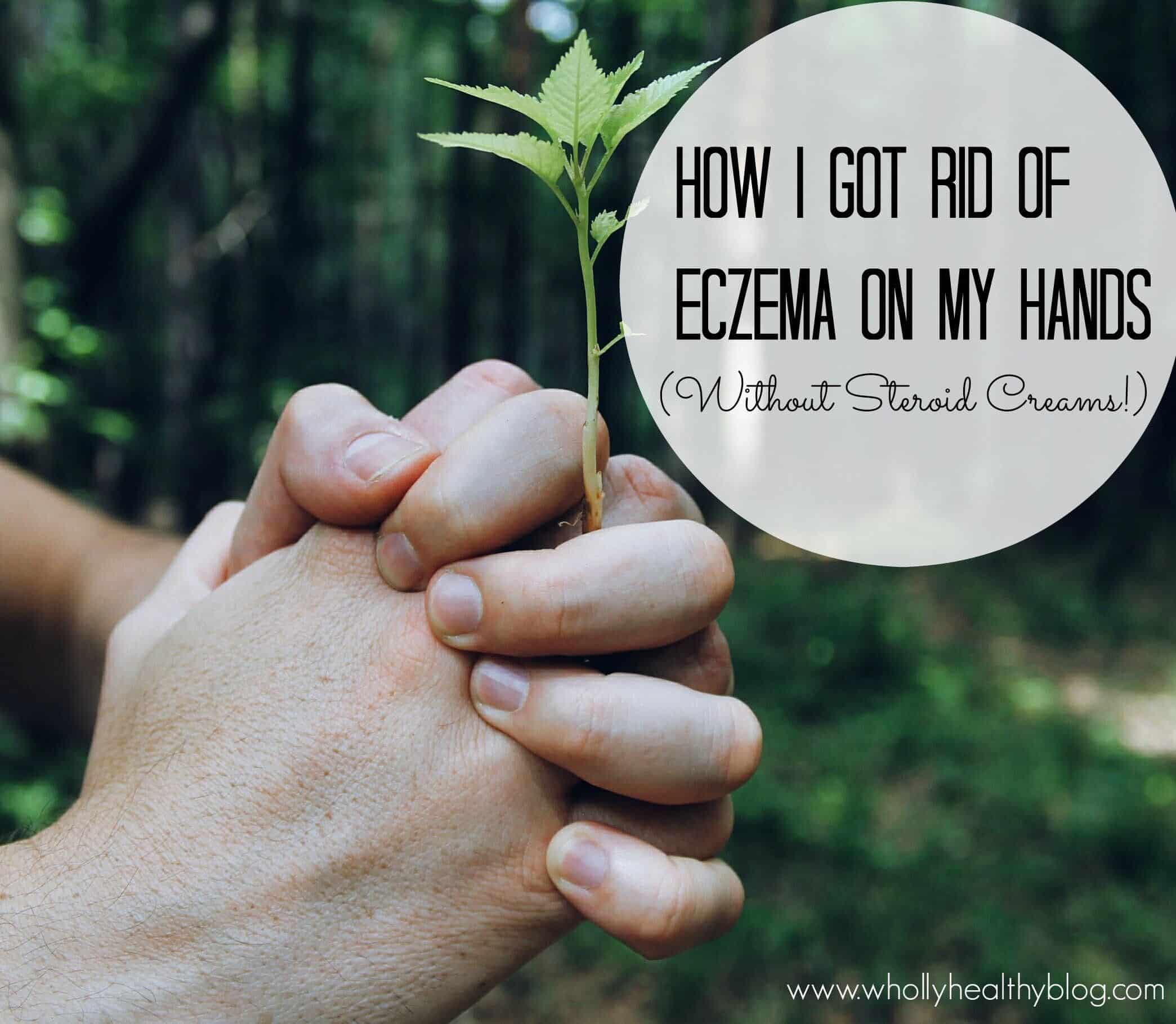 Natural treatments to manage eczema on hands #eczemadiet