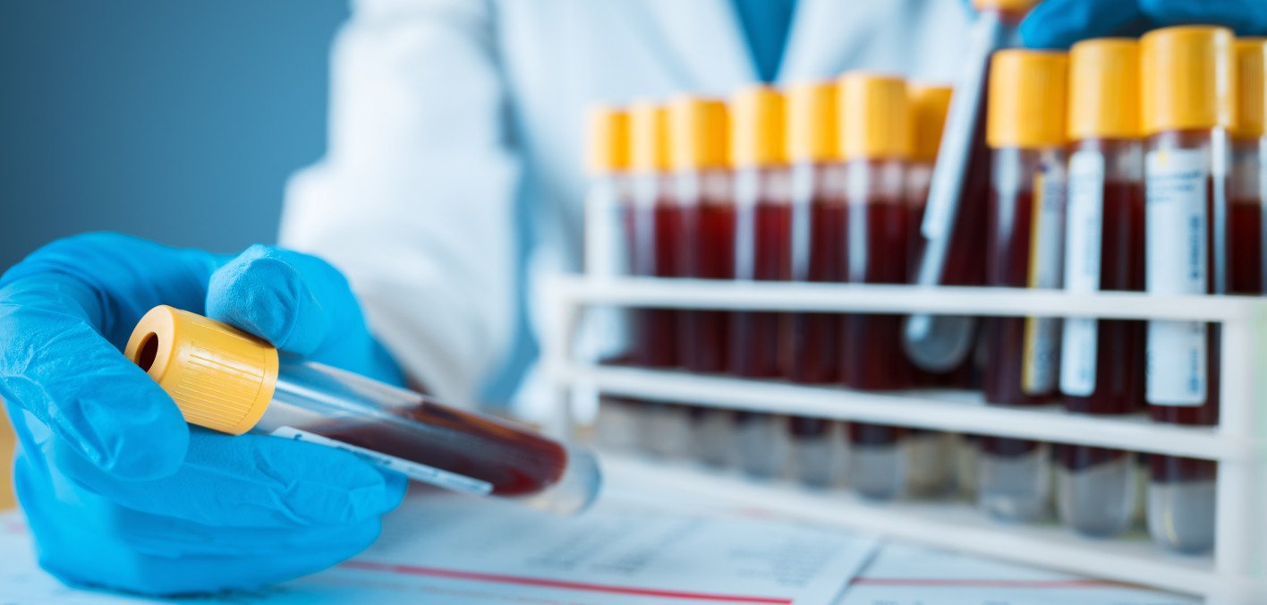 New Blood Test Can Detect Wide Range of Cancers