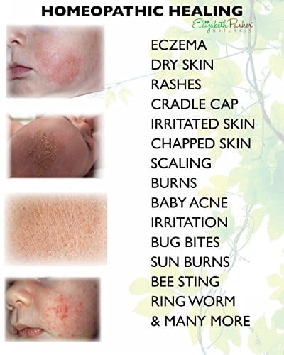Organic Baby Eczema Cream for Face and Body, Powerful Healing Formula ...