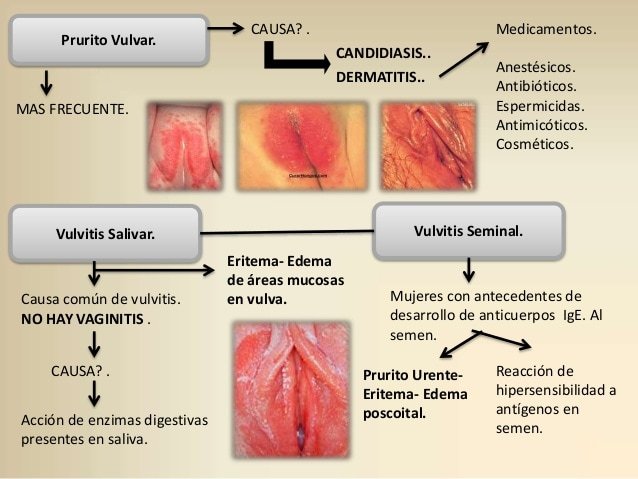 PatologÃa Benigna Genital. 2015