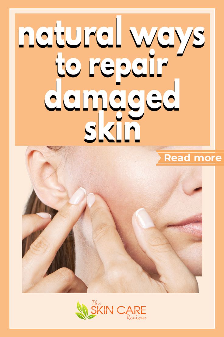 Pin on Dry Skin Care Tips