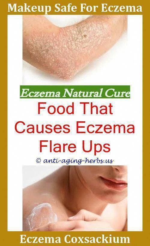 Pin on Eczema Routines