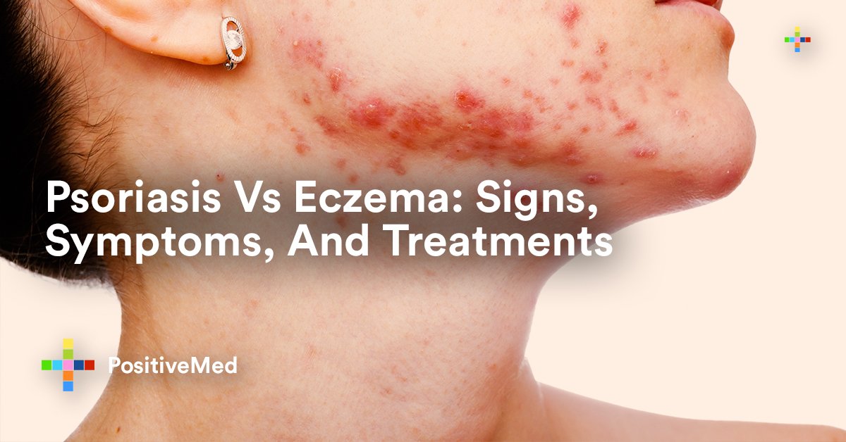 Psoriasis Vs Eczema: Signs, Symptoms, And Treatments ...