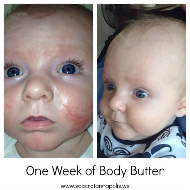 Seacret body butter works great on eczema and is safe for babies ...